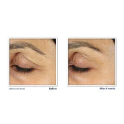 RoC Retinol Correxion Line Smoothing Oogcrème -Verzorging Voordeel Winkel 1021201 3