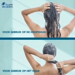 6x Head & Shoulders Conditioner DERMAxPRO 13 6x Head & Shoulders Conditioner DERMAxPRO -Verzorging Voordeel Winkel 1068946 6