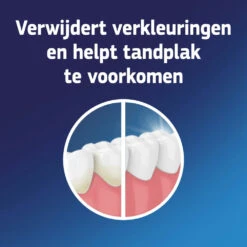6x Fixodent Reinigingstabletten Complete Care -Verzorging Voordeel Winkel 998573 3